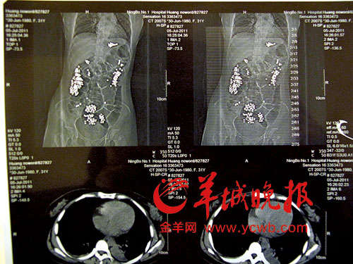 点击进入下一页